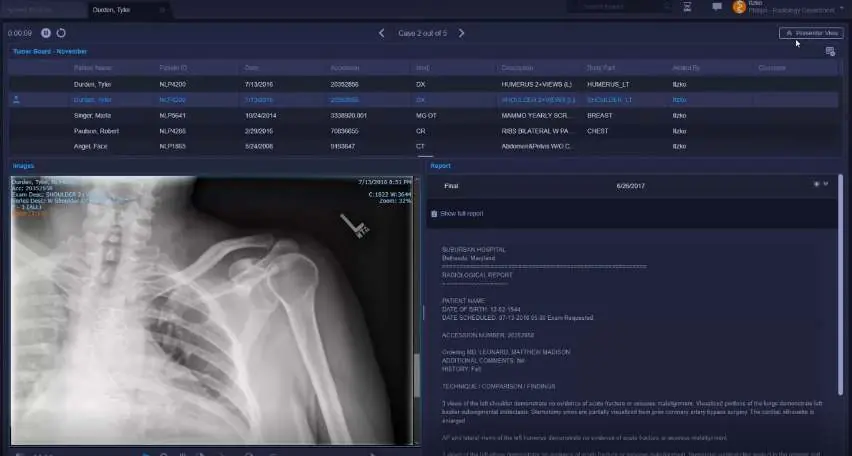 Widok Presenter View
